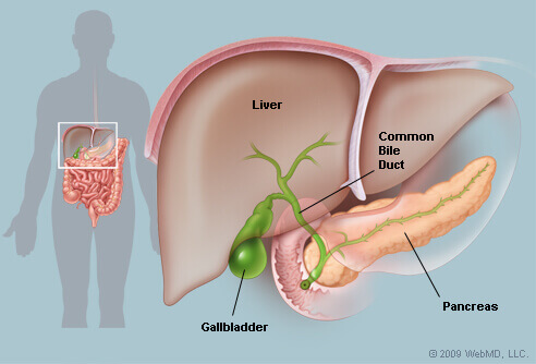 What Are The 3 Treatments For Gallstones?