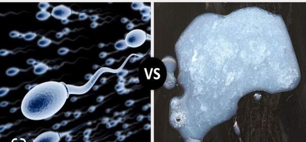 Differences Between Semen And Sperm